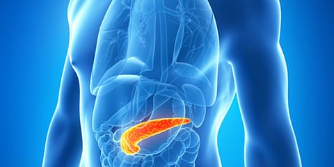 علاج لحماية البشر من الإصابة بسرطان البنكرياس