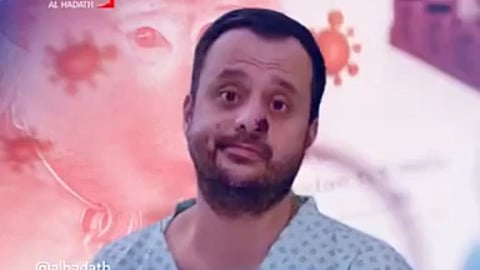 ممرض بريطاني يروي تجربته المرعبة مع جدري القرود: لم أتمكن من النوم.. وهكذا وصف الأطباء حالتي