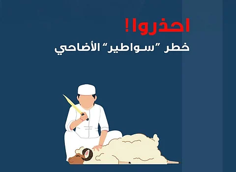 مستشفى الملك خالد يحذّر من خطر "سواطير" الأضاحي