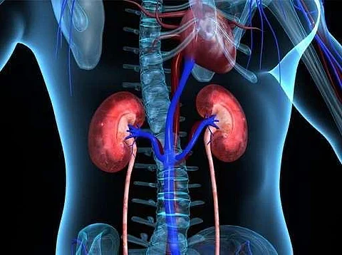 مستشفى الدكتور سليمان الحبيب بالسويدي يُجري عمليتين معقدتين لزراعة الكلى
