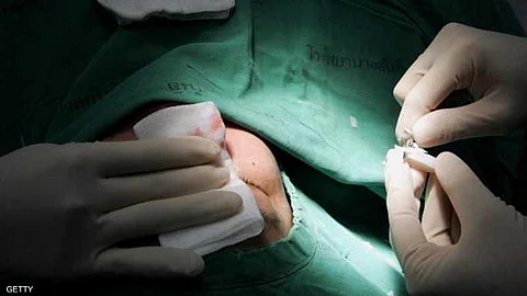 مستشارة أسرية: زوج يطلق زوجته بعد إجرائها عملية تجميلية