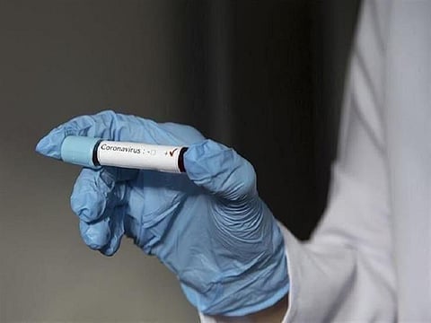 400 يوم ولا يزال مصابًا بـ"كورونا".. ماذا سيفعل الباحثون مع هذه الحالة؟!