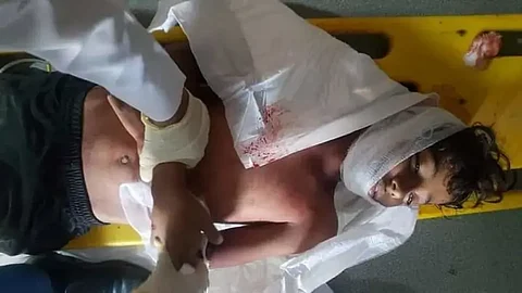 أحد ضحايا الهجوم الحوثي المسير في حجة