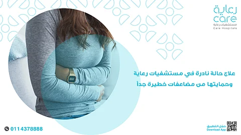 أنقذتها من مضاعفات خطرة.. جراحة ناجحة برعاية الملز لعلاج حالة نادرة لمريضة عشرينية