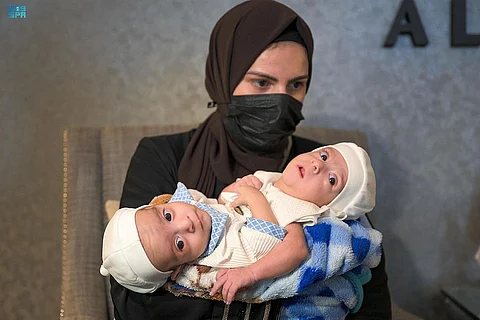 السعودية "أيقونة" فصل التوائم السيامية بخبرات وطنية عالية ومستشفيات متقدمة