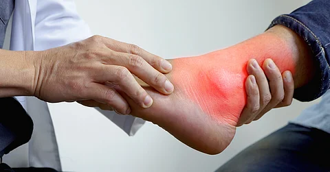 هل تعرف "داء الأثرياء"؟ إليك أعراضه وأسبابه وطريقة علاجه الفعالة!