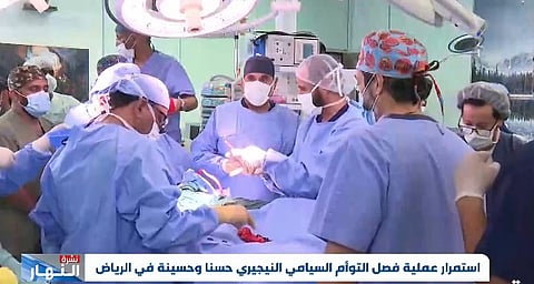 فيديو: لحظة فصل التوأم السيامي النيجيري "حسنا وحسينة"