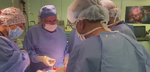 انتهاء المرحلة الثالثة من فصل التوأم السيامي النيجيري "حسانة وحسينة"