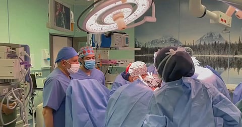 المرحلة الأطول.. عملية فصل السيامي النيجيري تصل إلى محطتها الـ"5"