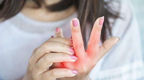 دراسة: 7 علامات "صامتة" على بشرتك لهذا المرض المزمن والخطير