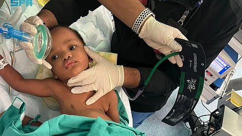 تحضيرات الفريق الطبي لعملية فصل التوأم السيامي النيجيري "حسانة" و"حسينة"