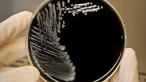 المرض ينجم عن بكتيريا توجد بكثرة في التربة