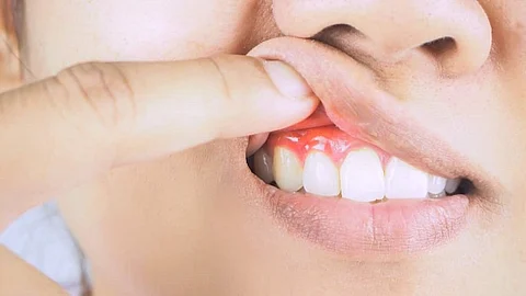 أمراض خطيرة يكشفها فمك.. علامات تشير للسرطان والإيدز وأكثر!