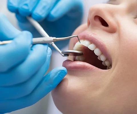 أكثر من 170 ألف مستفيد من خدمات طب الأسنان بعسير