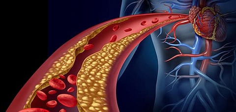 تحذير لأصحاب الكولسترول المرتفع.. "النمر": إيقافك للدواء يقودك لهذا الوضع