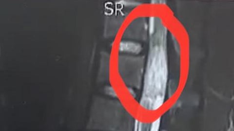 4 ساعات أعادت إليها الحركة.. استئصال ورم حساس بالعمود الفقري لخمسينية بالطائف
