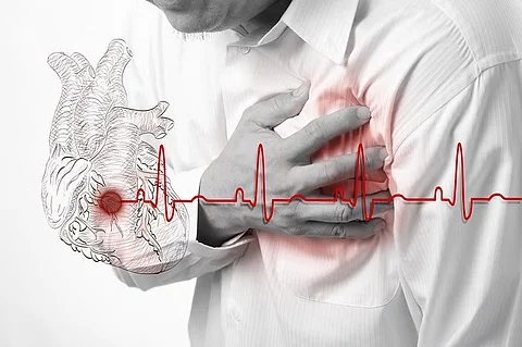 "متلازمة القلب المكسور".. حالة عاطفية يمكن أن تدمّر القلب وتؤدي للوفاة