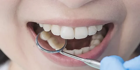 أحدها يوجِب مراجعة الطبيب فورًا.. أخصائية روسية تكشف أبرز 4 أنواع لألم الأسنان