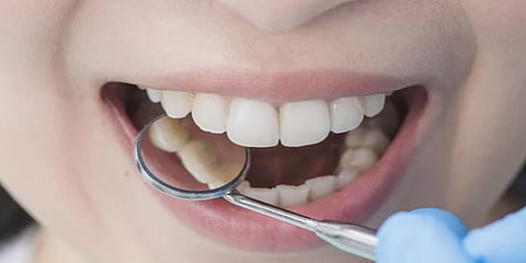 "الصحة الخليجي": 4 حلول فعالة للتعامل مع مشاكل الأسنان الحساسة