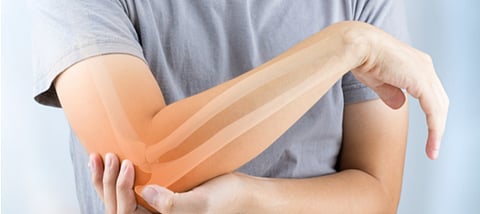 مدخل لهشاشة العظام.. دراسة تُحَذر من تجاهل علاج آلام وتيبس المفاصل