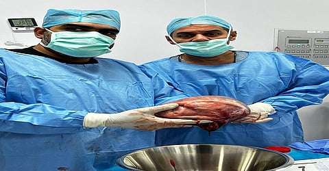 مستشفى حراء العام يُنهي معاناة مقيمة باستئصال كيس على المبيض بحجم 30 سم