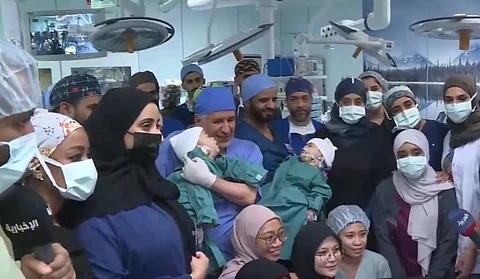 بعد نجاح عملية الفصل.. المشاهد الأولى لخروج التوأم السيامي "عائشة وأكيزا"