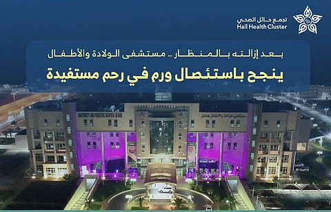 "ولادة حائل": إجراء عملية استئصال بالمنظار لورم أُصيبت بـه سيدة في العقد السادس من عمرها