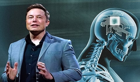 ماسك يعلن نجاح ثاني زراعة لشريحة إلكترونية في دماغ بشري