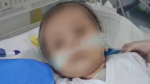  بعد توقُّف كافة الحلول الطبية وبعملية نوعية.. إنقاذ طفلة الـ22 يومًا بالمدينة المنورة