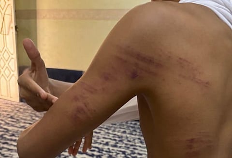 بوجاهة أعيان.. تنازل والد الطالب "المُساء له" يسدل الستار على حادثة "متوسطة" حائل