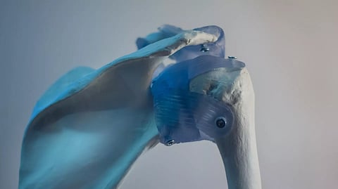 5 مؤشرات لهشاشة العظام.. احذر منها لتنجو من "القاتل الصامت"!