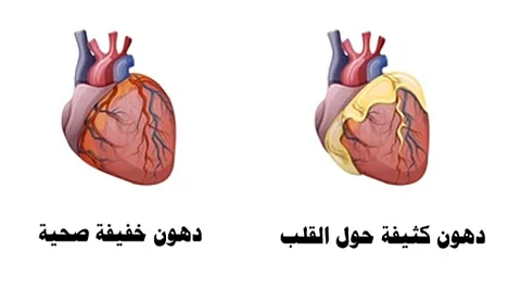 خبير: لهذه الأسباب "سمنة القلب" خطر على مناعة الإنسان