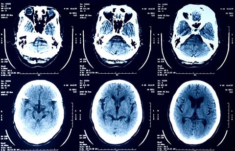 تقرير تقني يحذّر.. لا تحمّل صور أشعتك الطبية إلى روبوتات الدردشة بالذكاء الاصطناعي