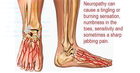 "الخضيري" يحذّر من ليونة بعض الأحذية ذات السمعة العالية