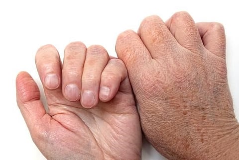 6 علامات للجفاف عند الكبار والصغار خلال فصل الشتاء