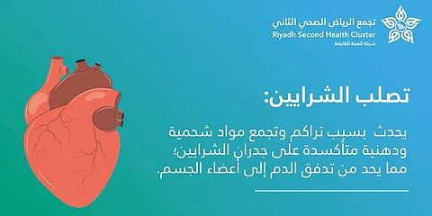 "فهد الطبية": ارتفاع الكوليسترول والسمنة من عوامل الخطورة للإصابة بتصلب الشرايين