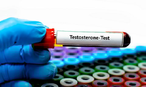 من تساقط الشعر إلى السمنة.. 10 علامات تدل على نقص هرمون التستوستيرون لدى الرجال