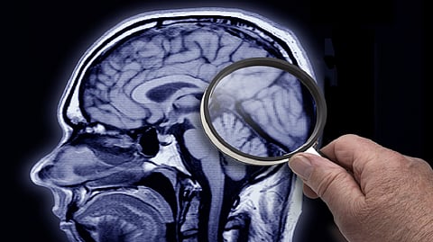 تظهر قبل 11 عامًا .. احذر من علامتين قد تكشفان خطر الإصابة بالخرف