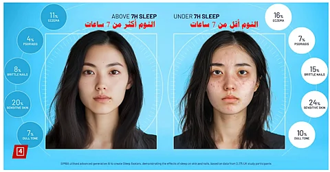 بتحليلات وصور الذكاء الاصطناعي.. شاهد التأثيرات غير المتوقعة على الجسم بسبب قلة النوم