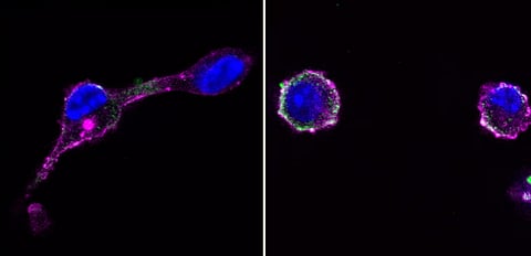 انجاز علمي يساعد على علاج فعال للمرض.. دراسة بريطانية تكتشف طريقة انتشار الأورام السرطانية في الجسم