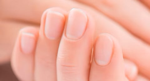 متى قصصت أظافرك آخر مرة؟.. طبيب أمريكي: علامات على أظافرك تكشف عن عمرك وصحتك