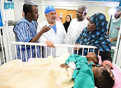 إنفاذاً لتوجيهات خادم الحرمين وولي العهد.. بدء عملية فصل التوأم السيامي البوركيني "حوى وخديجة"