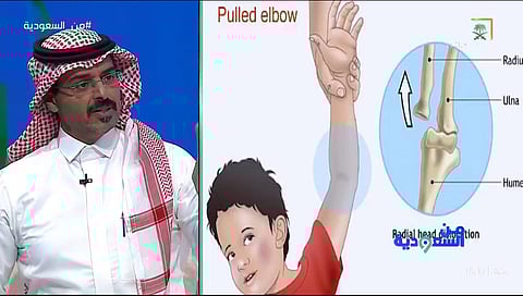 تجنب هذه الأفعال… مختص يحذر: رفع الأطفال من يد واحدة قد يؤدي إلى انفصال عظام الساعد