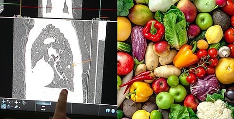 النظام الغذائي وسرطان الرئة.. دراسة تكشف علاقة استبعدتها الأبحاث في الماضي