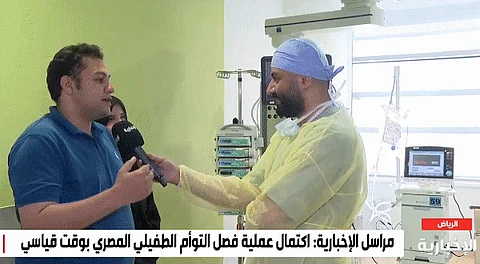 نجاح عملية فصل التوأم الطفيلي المصري بعد جراحة استغرقت 8 ساعات
