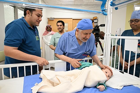 بدء المرحلة الـ 3 من عملية فصل التوأم الطفيلي المصري "محمد جمعة"