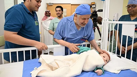 انتهاء عملية فصل التوأم الطفيلي المصري في وقت قياسي بمستشفى الملك عبدالله التخصصي