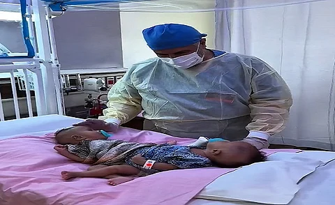 "الربيعة" يطمئن على صحة التوأم الملتصق الصومالي "رحمة ورملا" بعد وصولهما الرياض