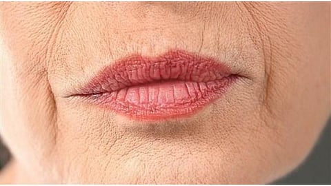 عادة يومية شائعة قد تسرع ظهور التجاعيد حول الفم