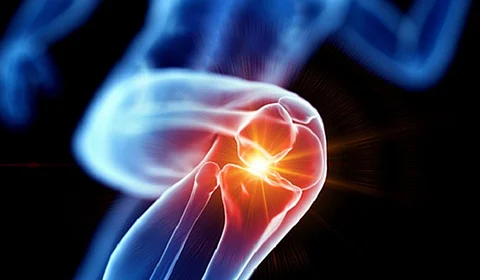 حالة واحدة توجب استشارة الطبيب.. أخصائية علاج طبيعي: 5 حلول فعالة لتخفيف طقطقة الركبة